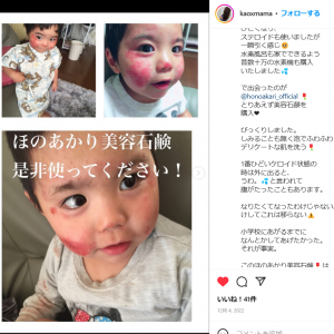 VOICE | ほのあかり美容液石鹸